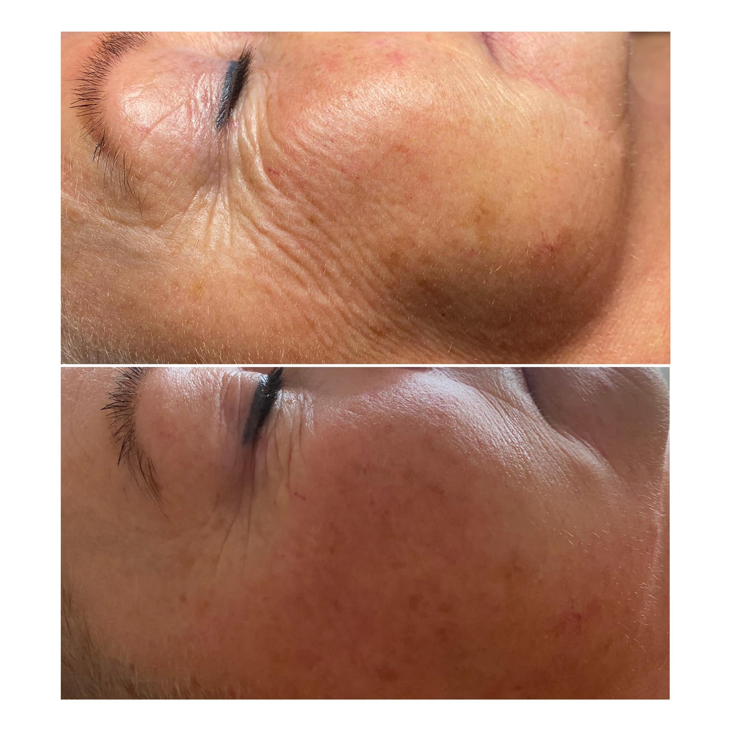 Tilbud: Organic Konjac Natural C-shaped Eye Mask